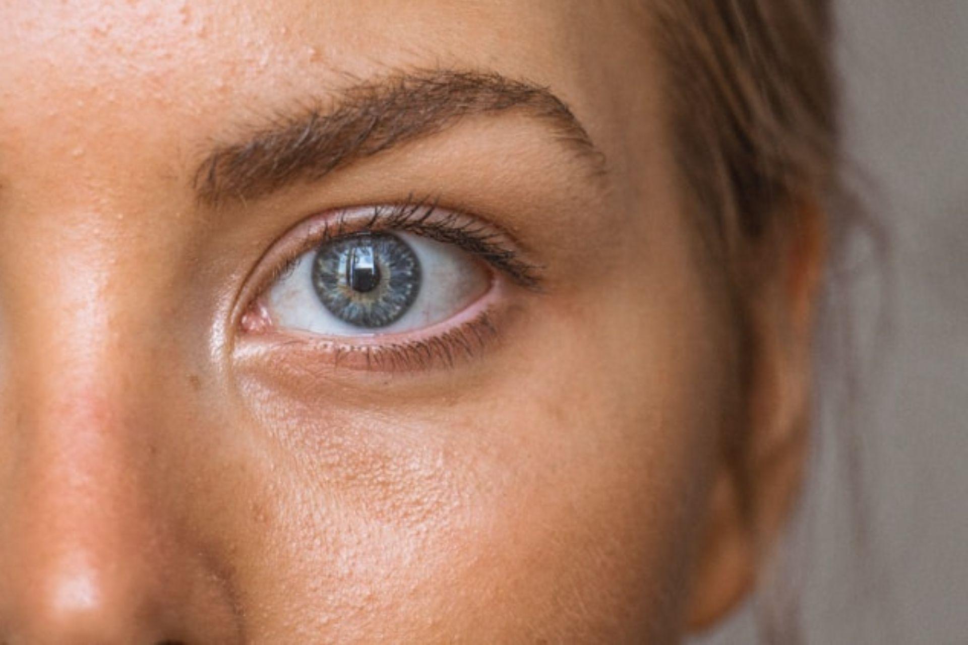 zsíros bőr fényvédő zsíros bőrre