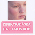 Minden, amit tudni kell a kipirosodásra hajlamos bőrről
