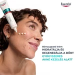Kép 7/10 - Eucerin DermoPure Clinical Hydra Repair - Bőrnyugtató krém 50ml