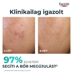 Kép 7/10 - Eucerin DermoPure Clinical Peeling 10 - Bőrmegújító szérum 40ml
