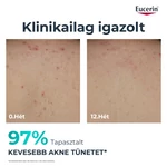 Kép 3/10 - Eucerin DermoPure Clinical Correcting Body Care - Testkrém 200ml