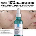 Kép 5/8 - La Roche-Posay Effaclar DUO+ Ultra Koncentrált Szérum 30ml