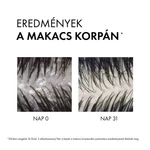 Kép 4/7 - Vichy Dercos korpásodás elleni sampon száraz hajra 200 ml