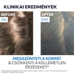 Kép 7/8 - Uriage D.S. HAIR Sampon korpás fejbőrre 500ml