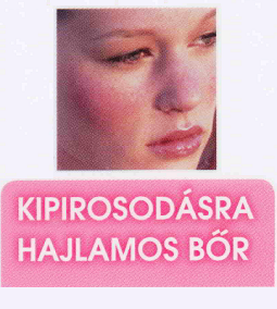 Minden, amit tudni kell a kipirosodásra hajlamos bőrről