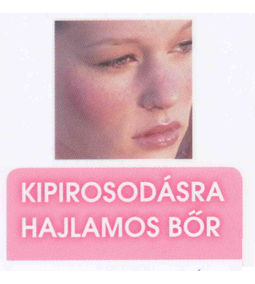 Minden, amit tudni kell a kipirosodásra hajlamos bőrről