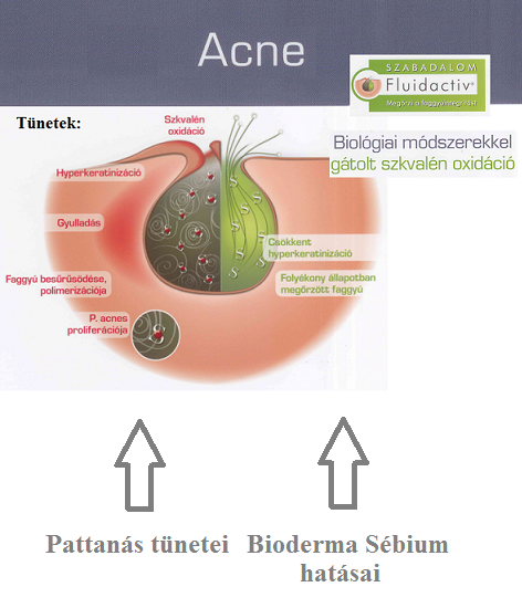 Bioderma Sébium zsíros bőr program, Bioderma webáruház - Dermaonline.hu, Bioderma termékek, Sébium termékek