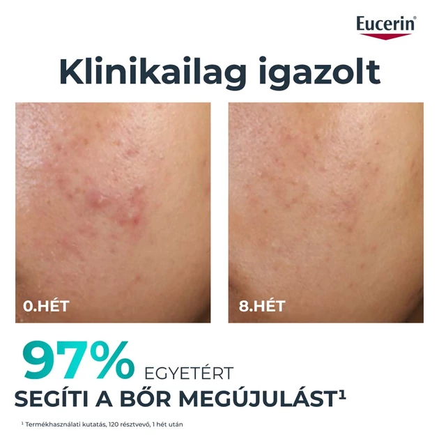 Eucerin DermoPure Clinical Peeling 10 - Bőrmegújító szérum 40ml