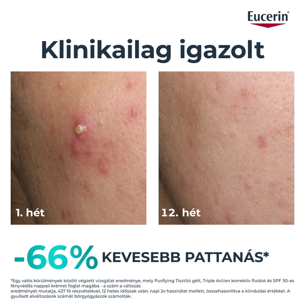 Eucerin DermoPure Clinical Triple Action - Korrektív Fluid 40ml