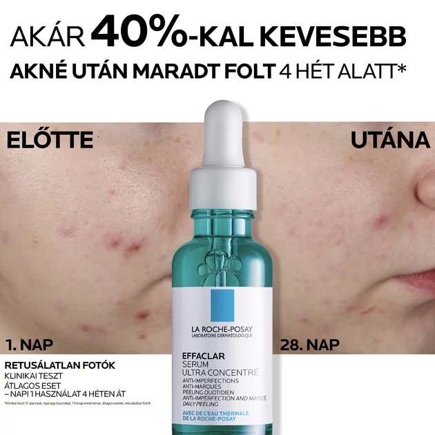 La Roche-Posay Effaclar DUO+ Ultra Koncentrált Szérum 30ml