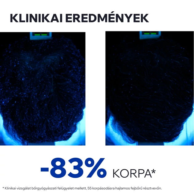 Uriage D.S. Lotion spray korpás fejbőrre 100ml